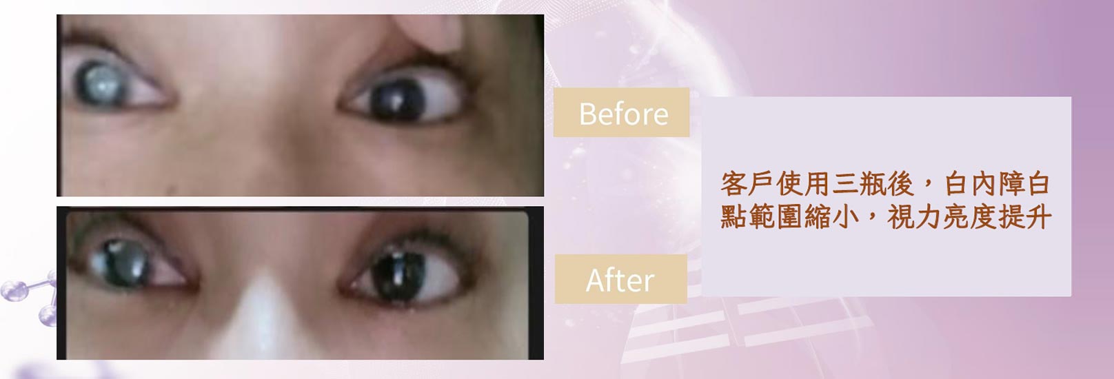 韓后醫美 愛法洛 ÉVOL 韓國外泌體 眼睛 滴眼液