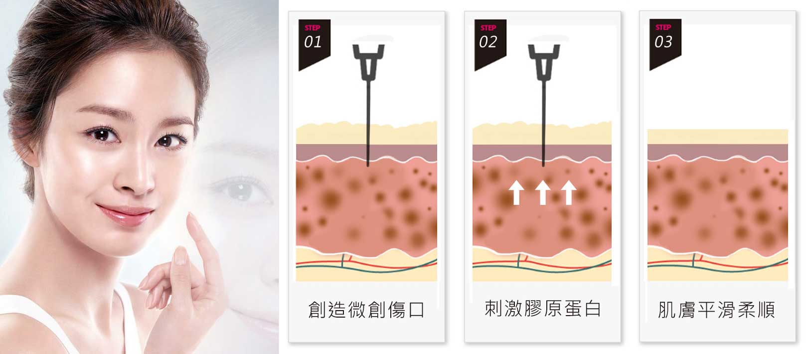 韓后醫美 韓國皮膚管理:創造為創傷口、刺激膠原蛋白、肌膚平滑柔順。