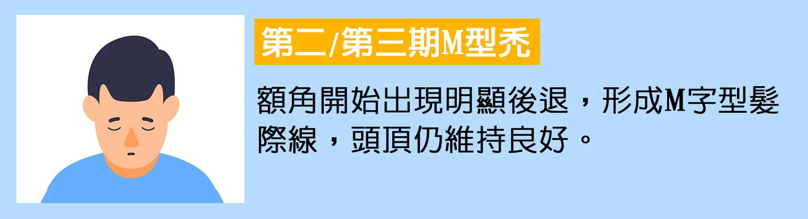 第二/三期M型禿：額角開始出現明顯後退，形成M字型髮際線，頭頂仍維持良好。韓后醫美