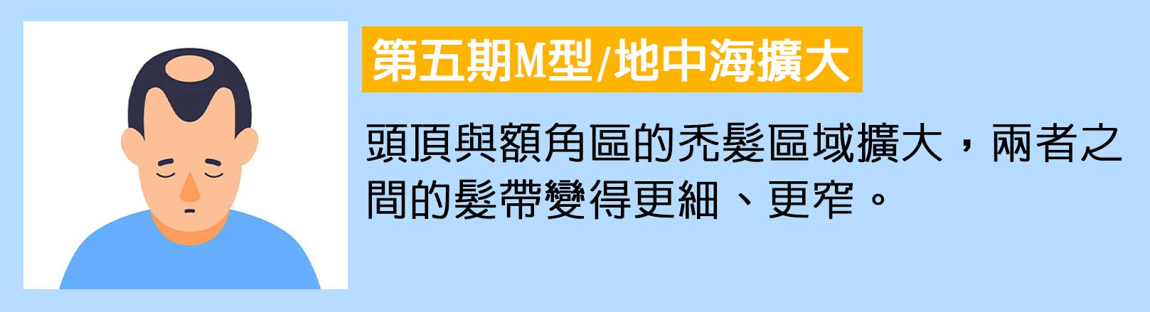第五期M型/地中海擴大：頭頂與額角區的禿髮區域擴大，兩者之間的髮帶變得更細、更窄。韓后醫美