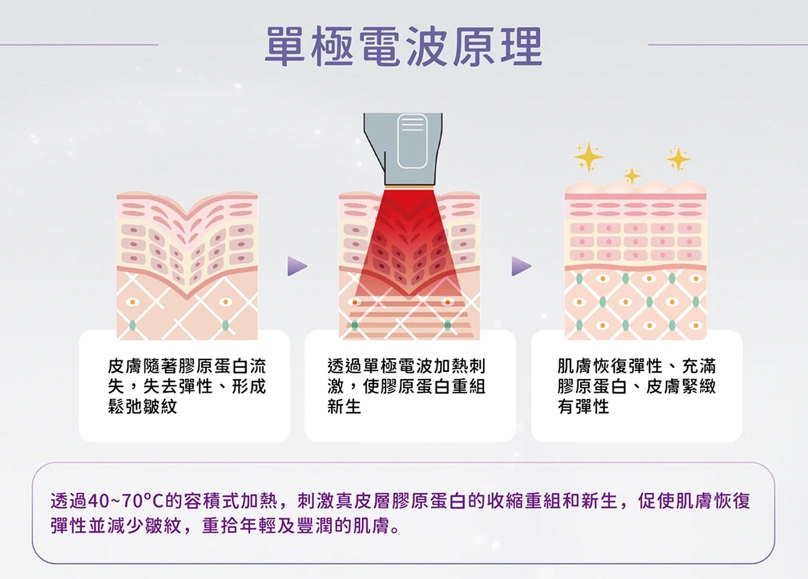 韓后醫美,十倍電波,十蓓電波,電波的原理：十倍電波就像個溫暖的魔法師，用它的高頻交流電輕輕進入肌膚的深層，像是在真皮層裡施展了一場40°C~70°C的熱能魔法。這股熱力不僅讓皺紋開始變淡，肌膚也變得越來越緊緻。最棒的是，這位魔法師的法力還不會馬上消失，做完療程後，這份緊緻感能持續下去，讓肌膚一天比一天更有彈性！