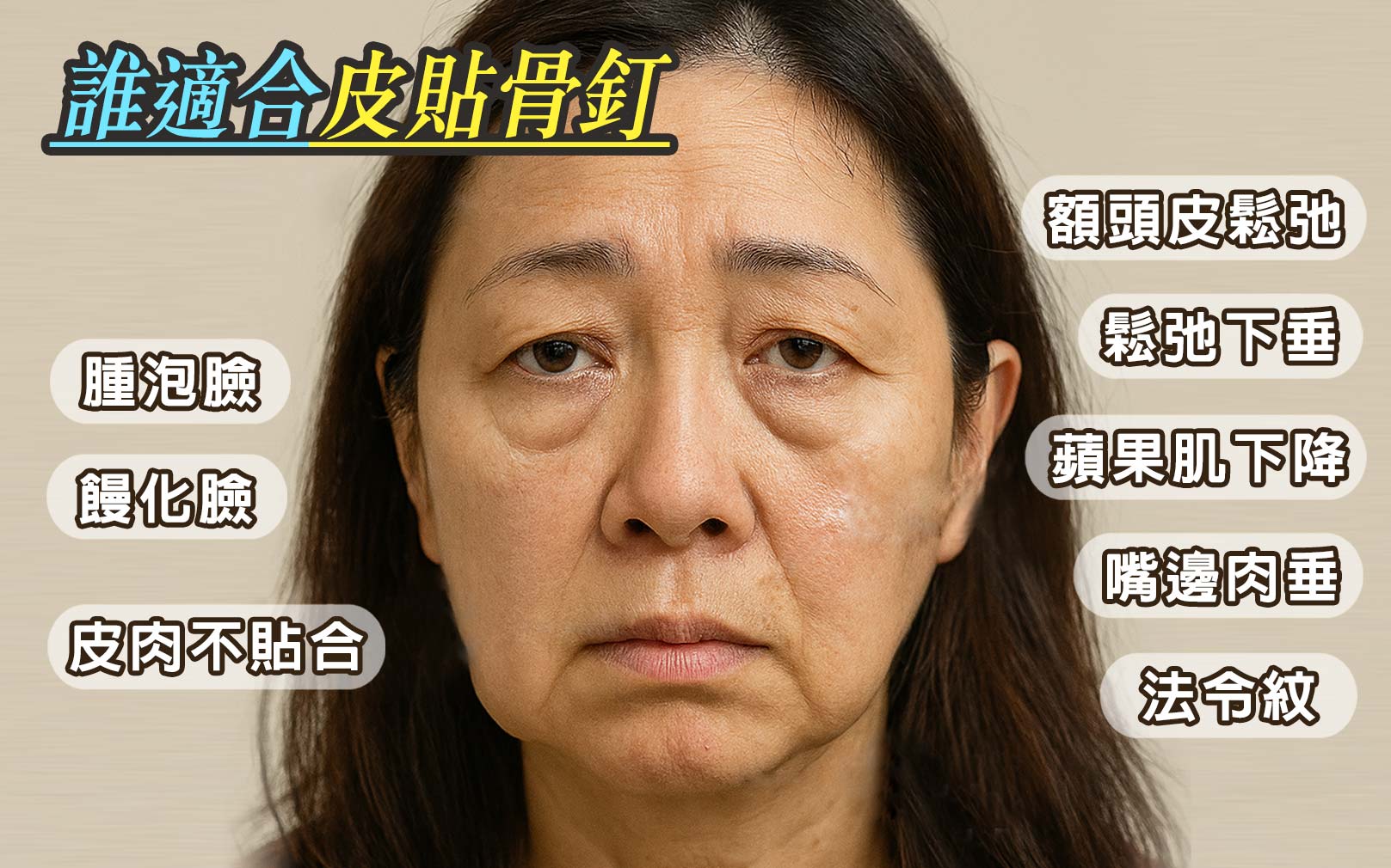 皮貼骨釘適合對象：皮肉不貼合、饅化臉、下垂鬆垮臉、蘋果肌鬆垮、嘴邊肉垂、腫泡臉、脂肪多。韓后醫美