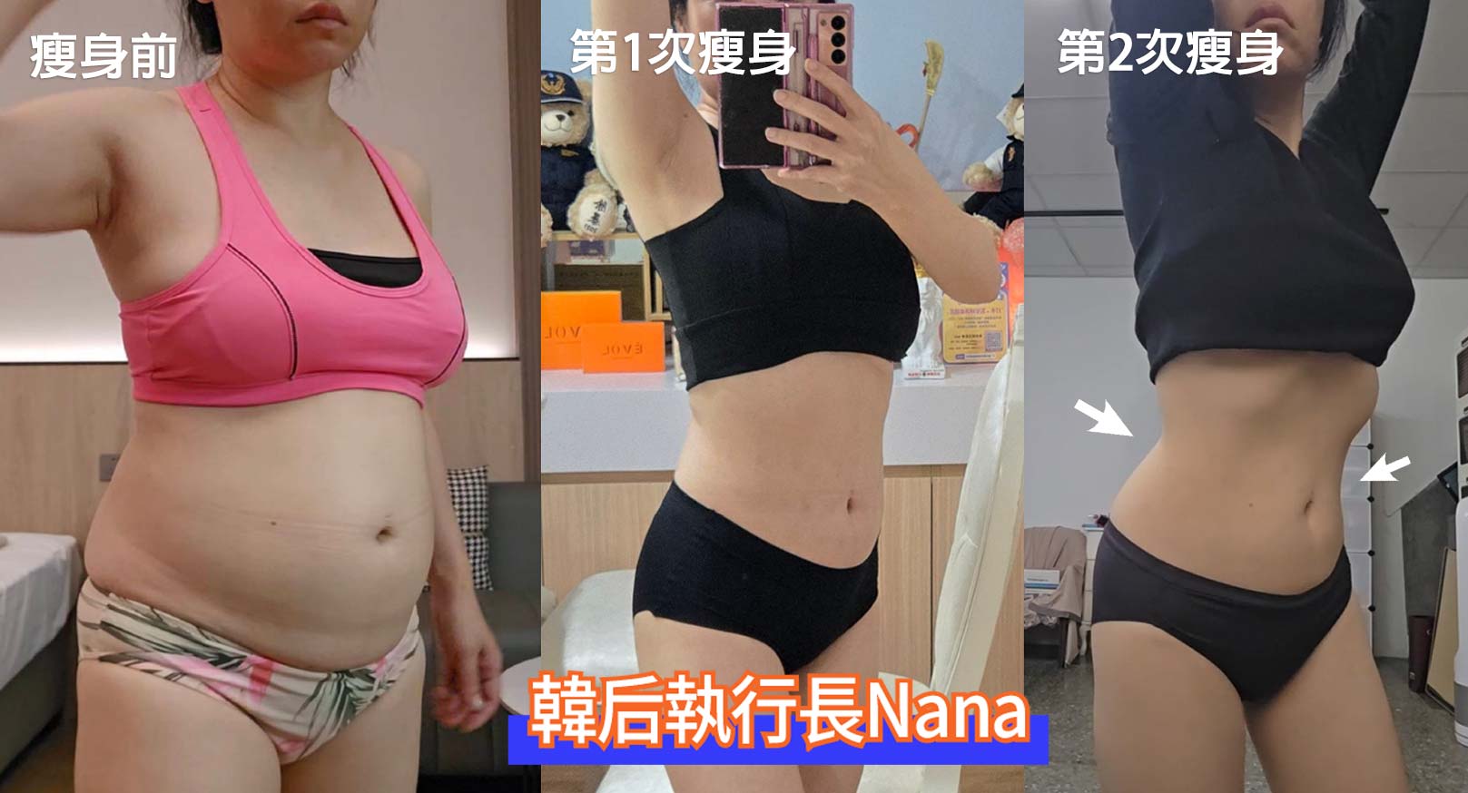 第2次瘦身,腰線,S曲線,幸福瘦身法,瘦身術,外泌體,穴位技術,代謝調理。醫美執行長,CEO,孔娜娜,減肥,瘦身,輕鬆瘦,幸福瘦身,幸福享瘦,韓后診所