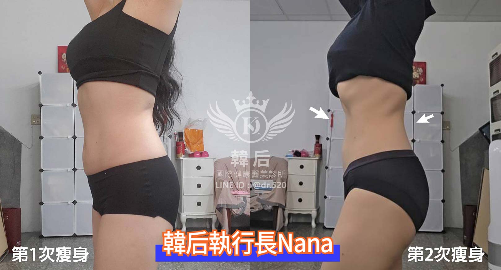 第2次瘦身,腰線,S曲線,幸福瘦身法,瘦身術,外泌體,穴位技術,代謝調理。醫美執行長,CEO,孔娜娜,減肥,瘦身,輕鬆瘦,幸福瘦身,幸福享瘦,韓后診所