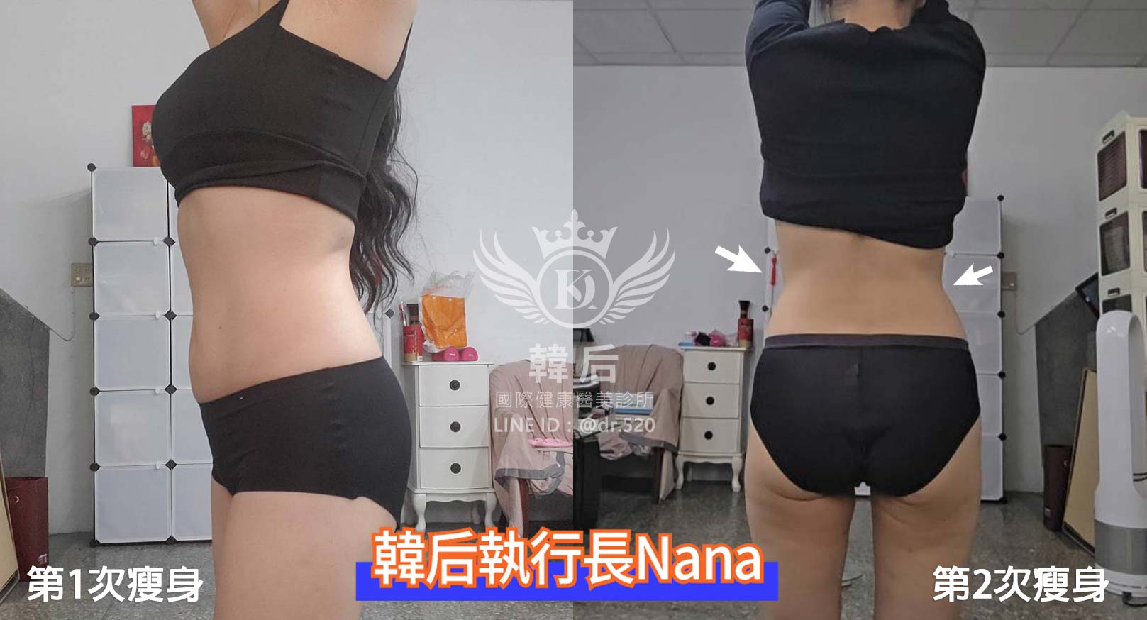 第2次瘦身,腰線,S曲線,幸福瘦身法,瘦身術,外泌體,穴位技術,代謝調理。醫美執行長,CEO,孔娜娜,減肥,瘦身,輕鬆瘦,幸福瘦身,幸福享瘦,韓后診所