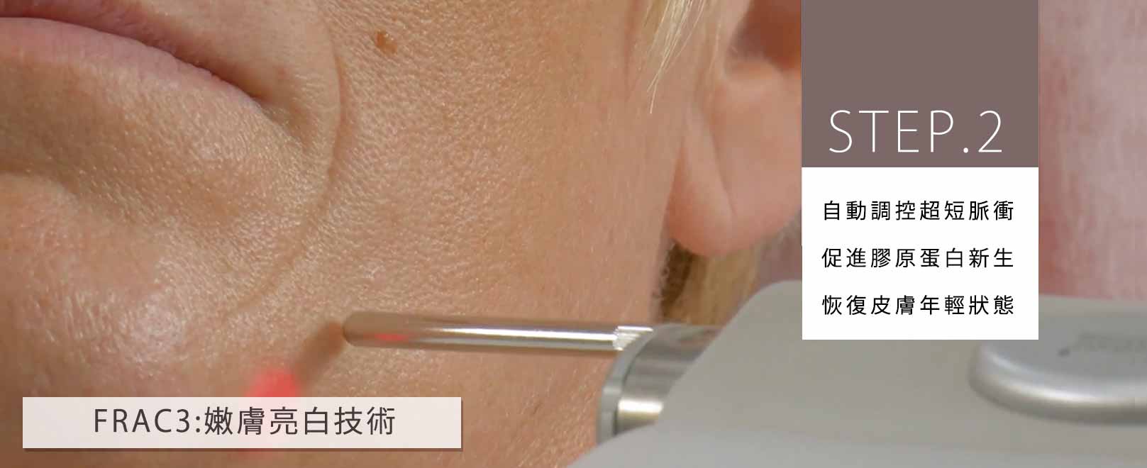 韓后醫美 4D口內拉提 STEP.2：自動調控超短脈衝，促進膠原蛋白新生，恢復皮膚年輕狀態。