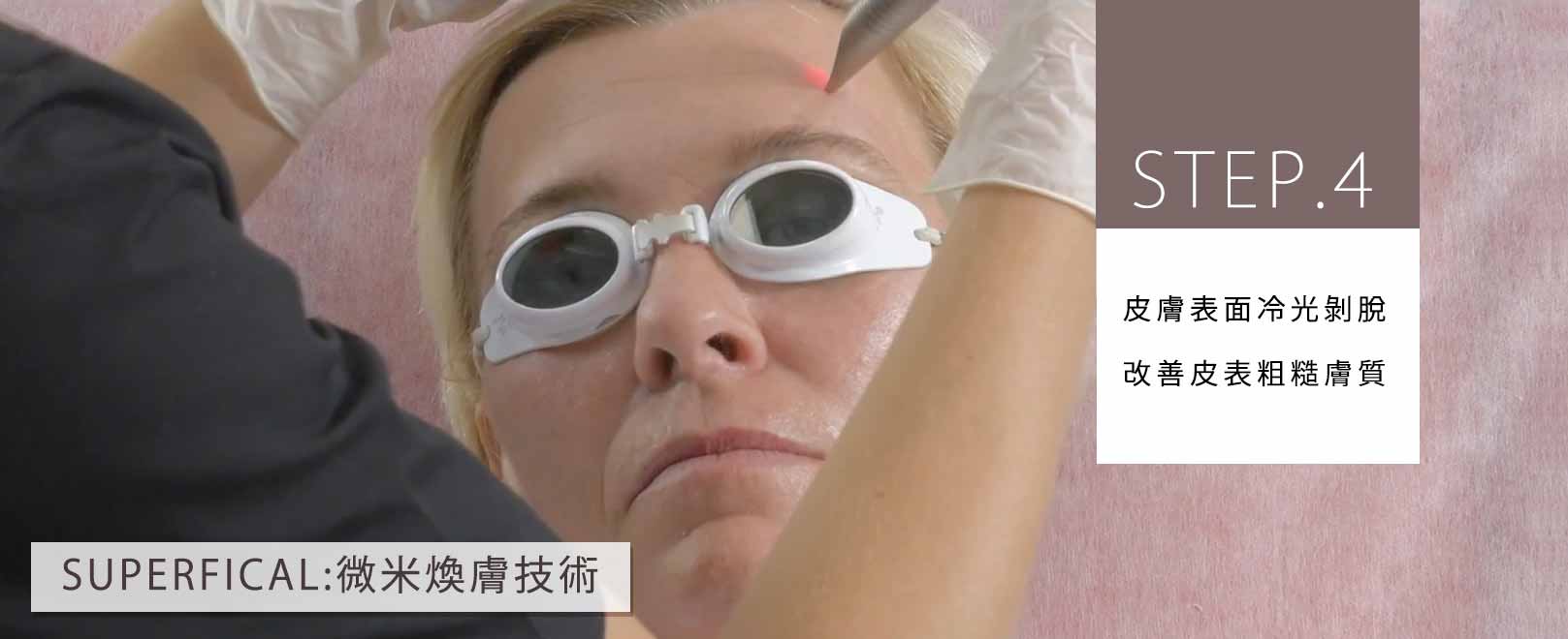 韓后醫美 4D口內拉提 STEP.4：皮膚表面冷光剝脫，改善皮表粗糙膚質。
