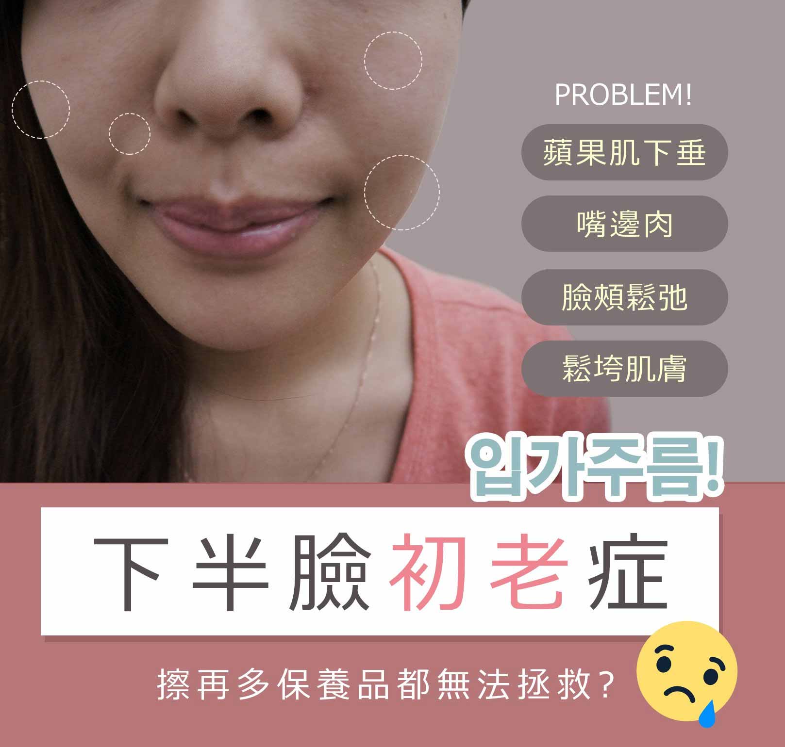 韓后醫美 4D口內拉提 素人真實案例