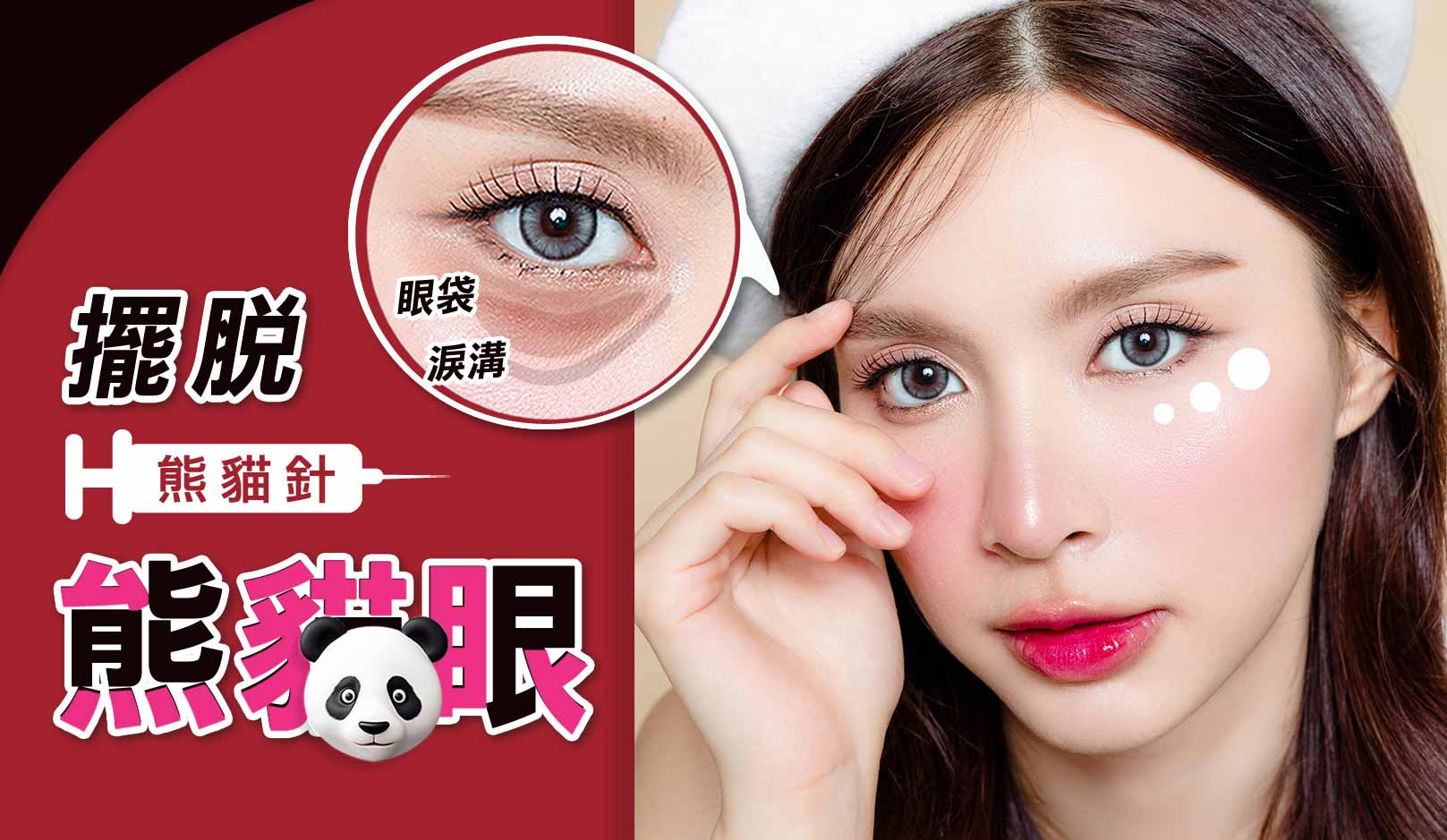 韓后醫美 膠原蛋白熊貓針 擺脫熊貓眼 看起來總是睡不飽嗎?改善色素型黑眼圈/眼周細紋