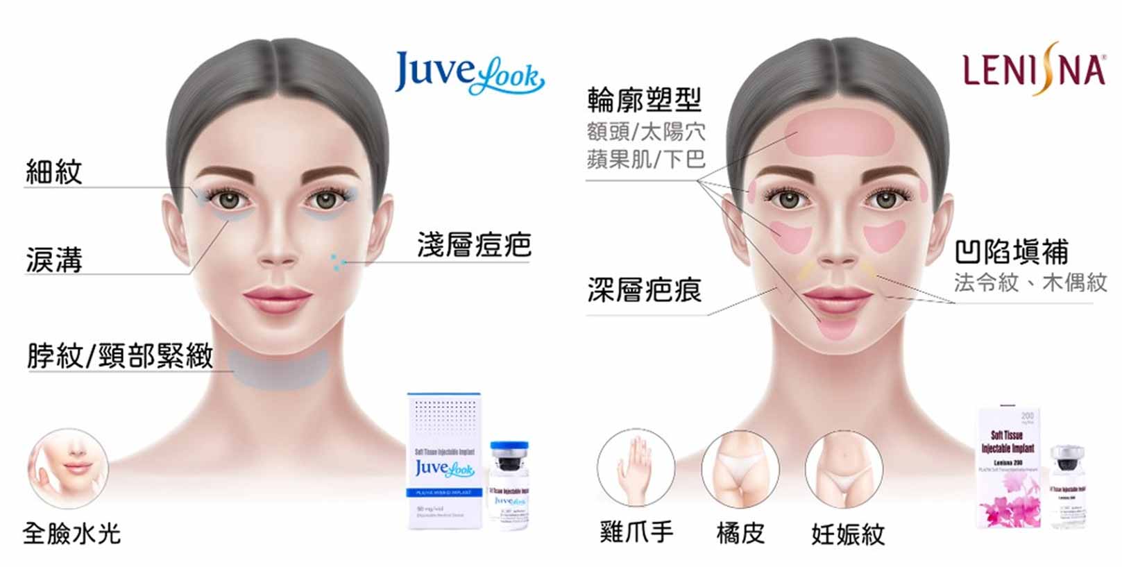 韓后醫美,艾喬雅露,Juvelook,新童妍,素顏針,提升輪廓：全臉拉提、中臉拉提、線臉拉提、顳後髮線拉提。改善凹陷：刺激膠原蛋白與彈性纖維增生,改善凹陷回復緊緻。柔嫩水潤肌膚