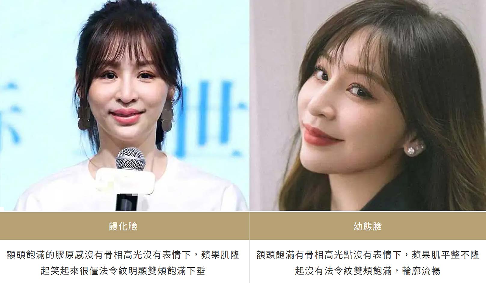 韓后醫美,饅化臉與幼態臉,王心凌