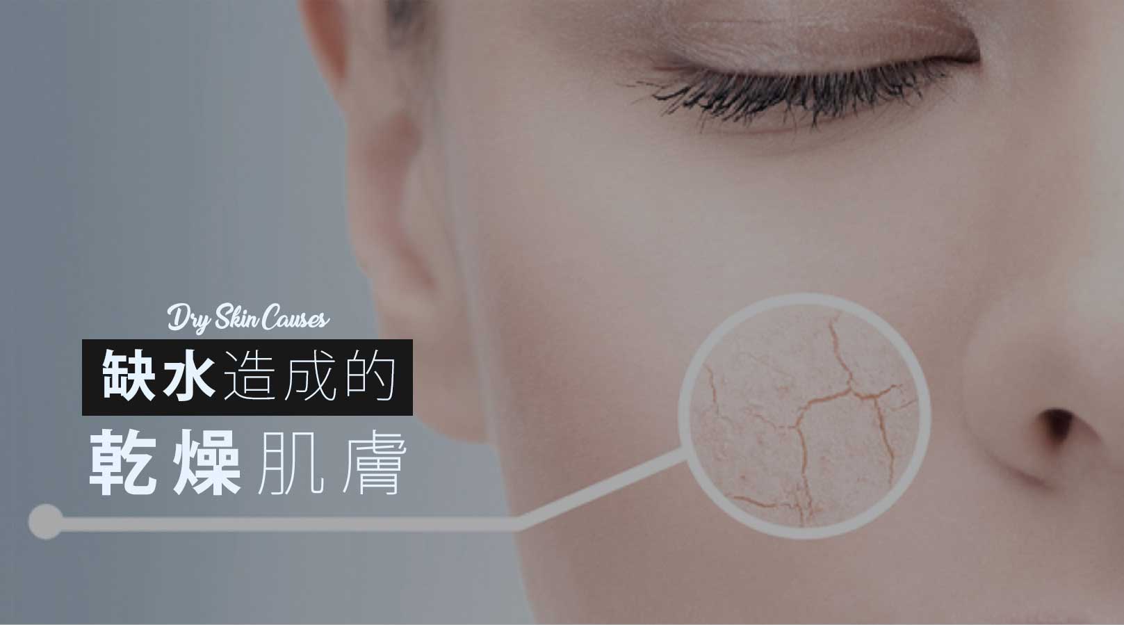 韓后醫美 水光保濕 皮膚缺水造成乾燥