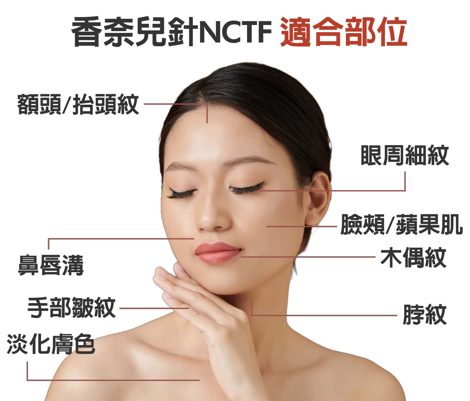 香奈兒針NCTF適合部位：額頭/抬頭紋,鼻唇溝,手部皺紋,淡化膚色,眼周細紋,―臉頰/蘋果肌,木偶紋,脖紋,韓后醫美,香奈兒針,NCTF,NCTF 135HA,小粉瓶