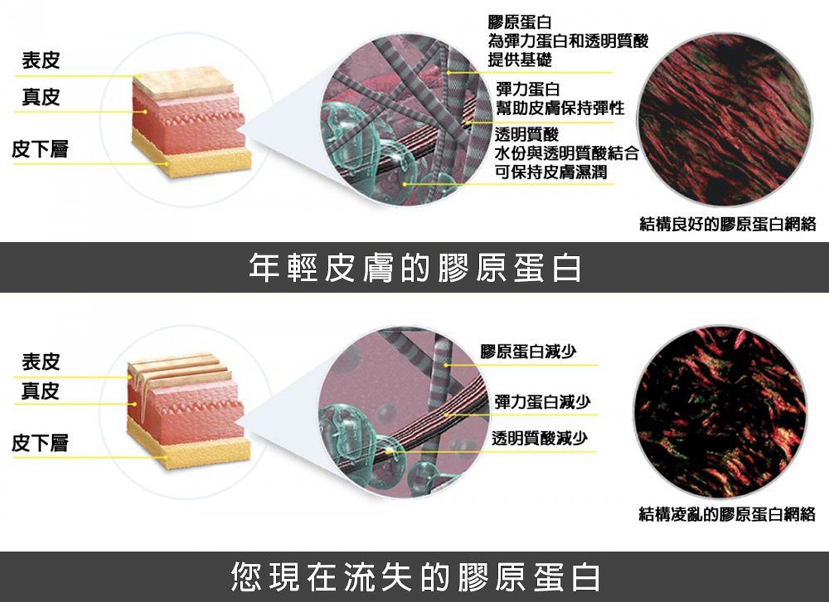 韓后醫美 洢蓮絲 膠原蛋白增生