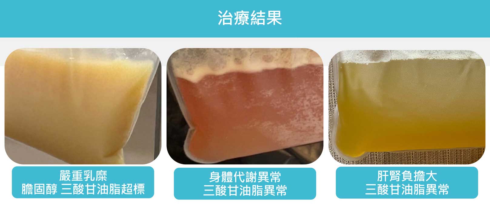 韓后醫美 TPE血液淨化 治療結果