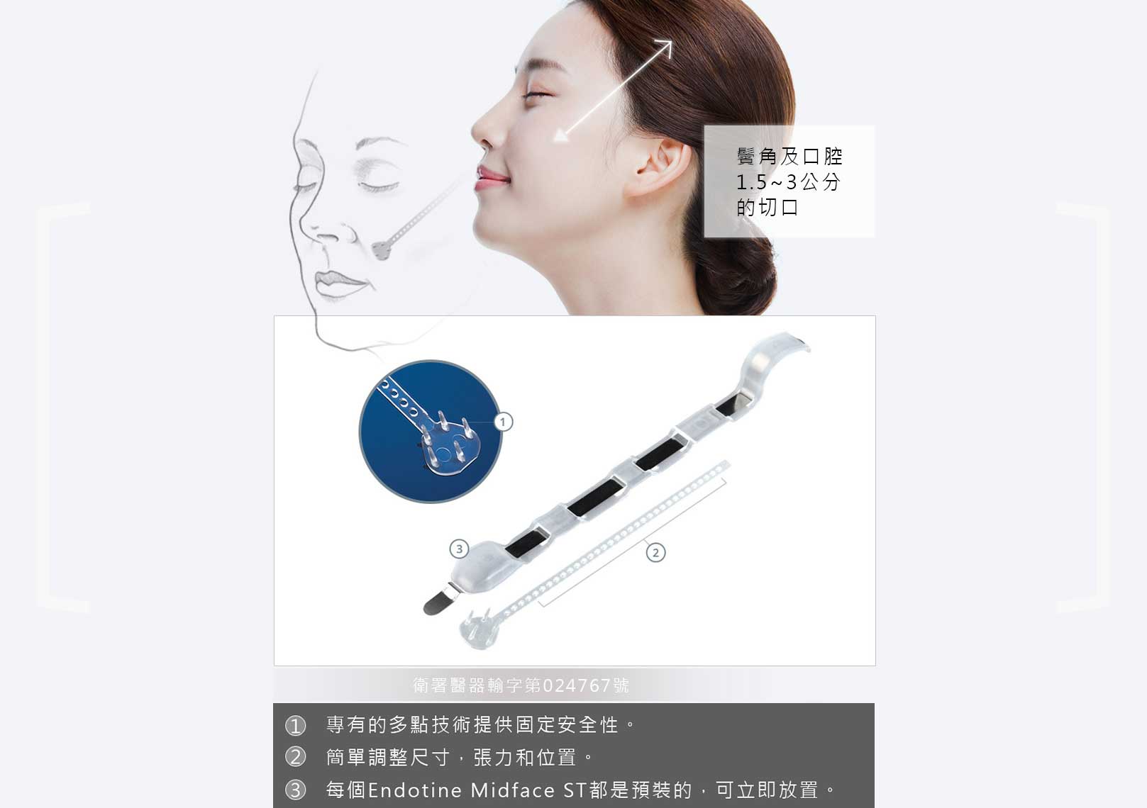 韓后醫美 內視鏡中臉拉提：鬢角及口腔1.5~3cm的切口。