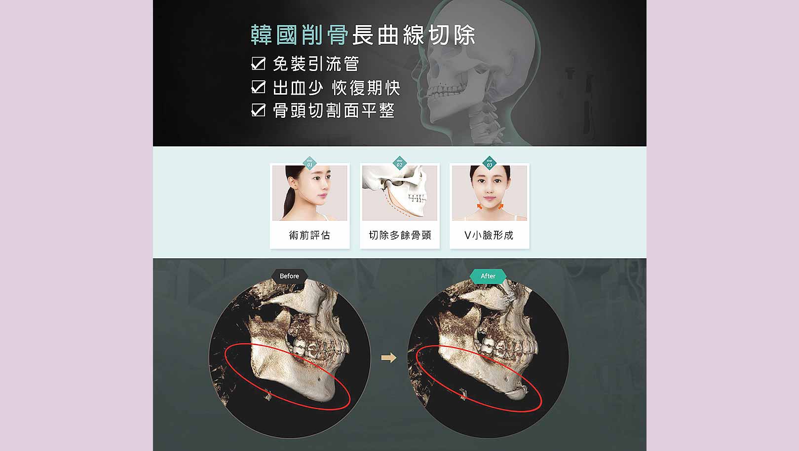 改善國字臉