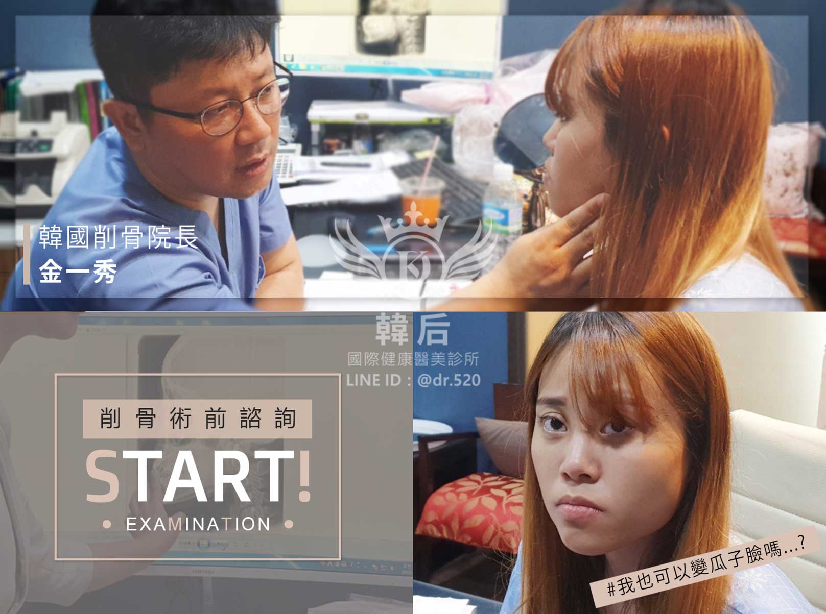 韓國削骨權威,削骨手術,金一秀院長,韓國削骨,磨骨,諮詢,面診,臉型雕塑,瘋狂小妞騏騏變美日記,騏騏,醫美,變美日記