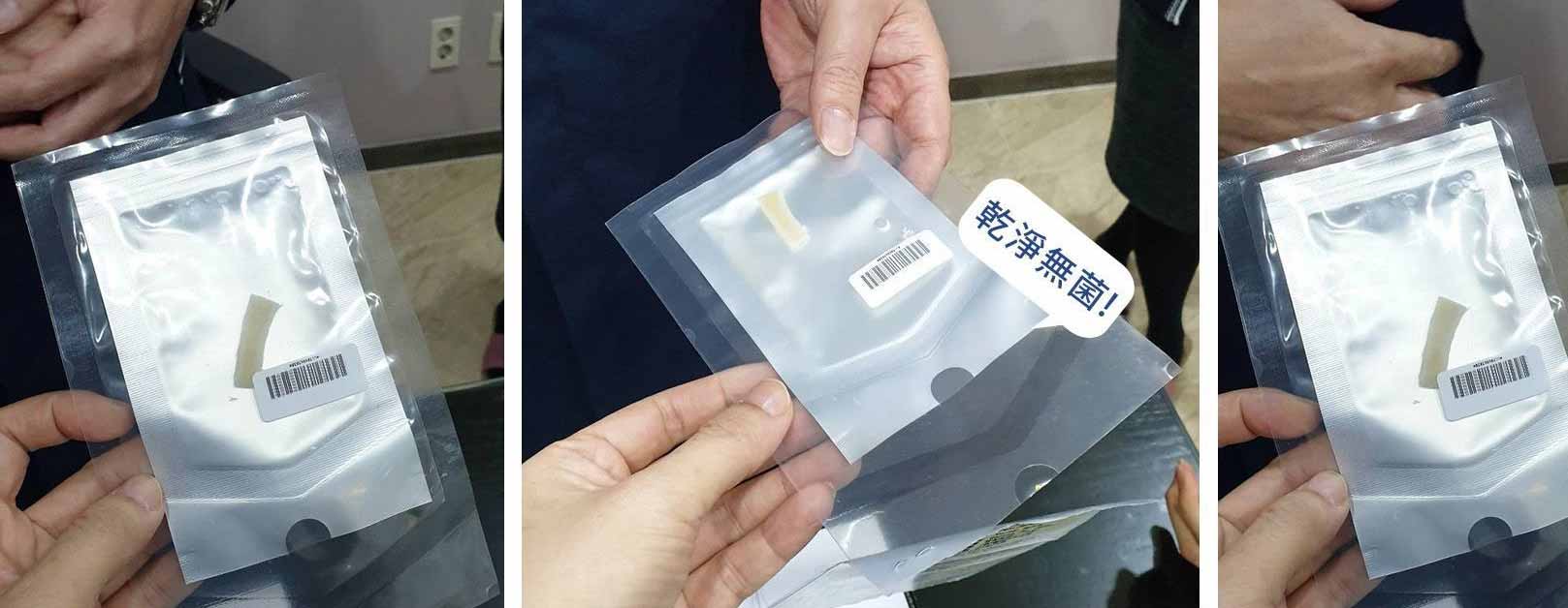 經過消毒殺菌的異體肋骨
