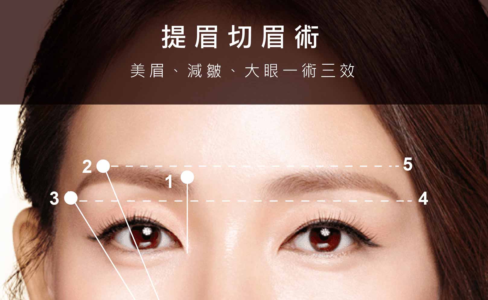 韓后醫美 提眉切眉術：美眉、減皺、大眼一術三效。