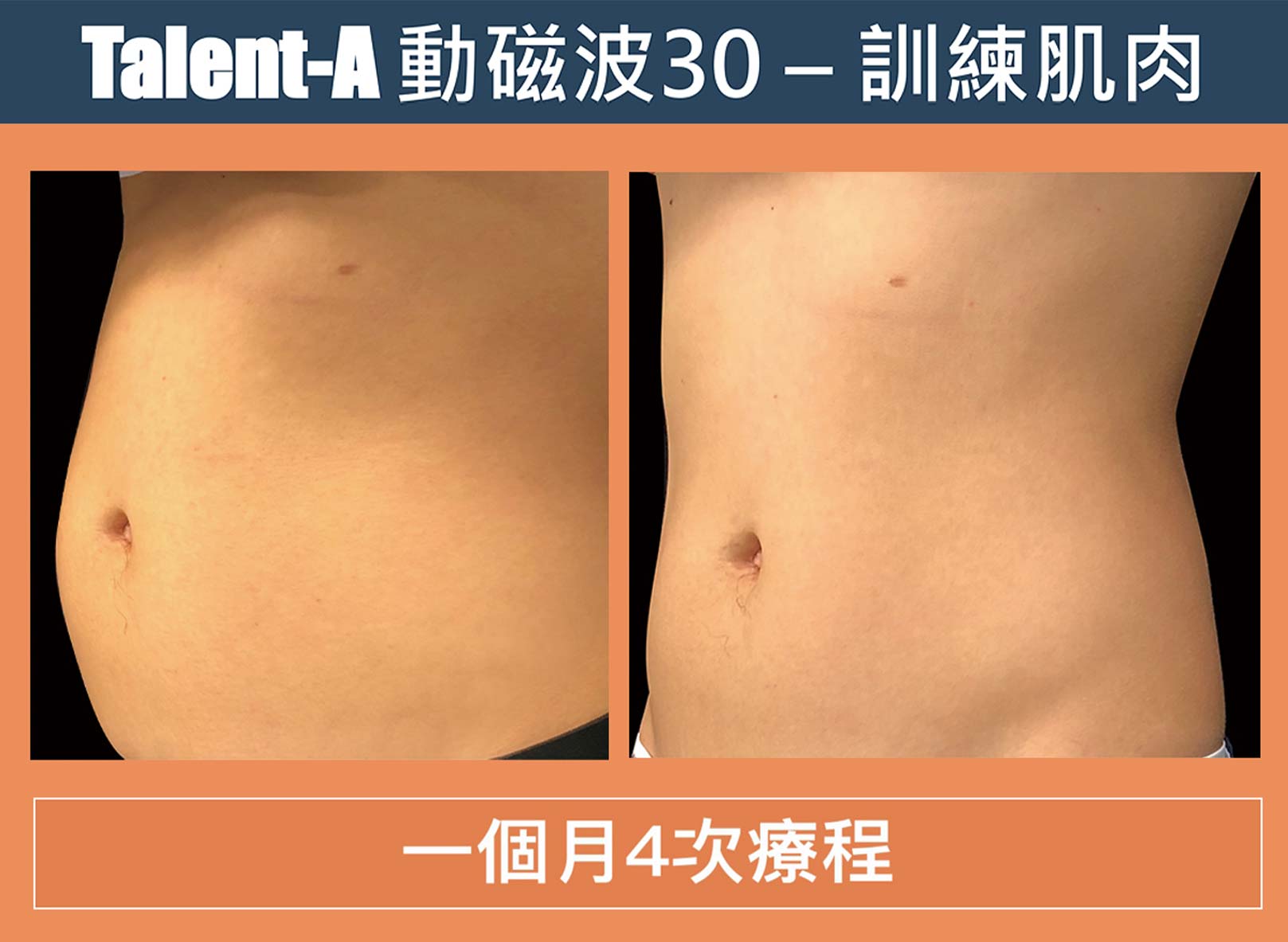 動磁波,被動式運動,腹肌,翹臀,健身,韓后醫美